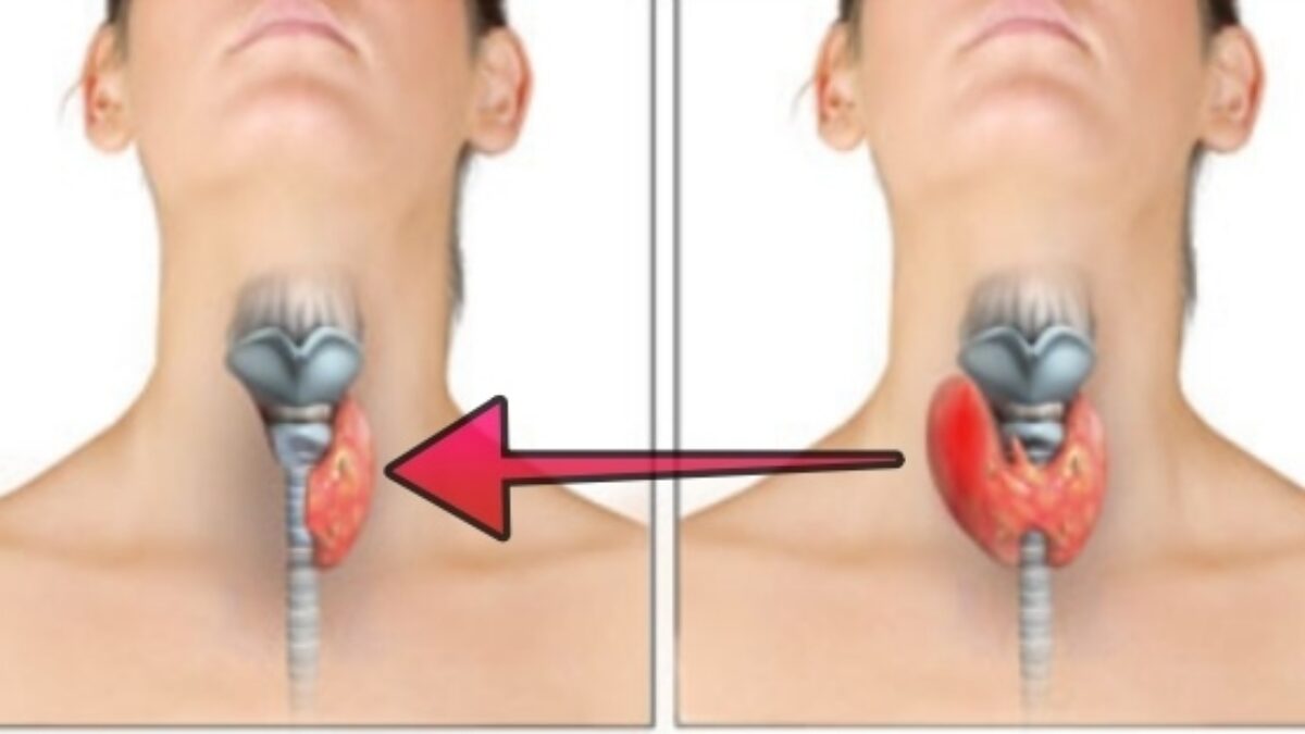 Konečne sa mi podarilo dať moju štítnu žľazu dokopy: 7 vecí o štítnej žľaze, ktoré som doteraz vôbec nevedela!