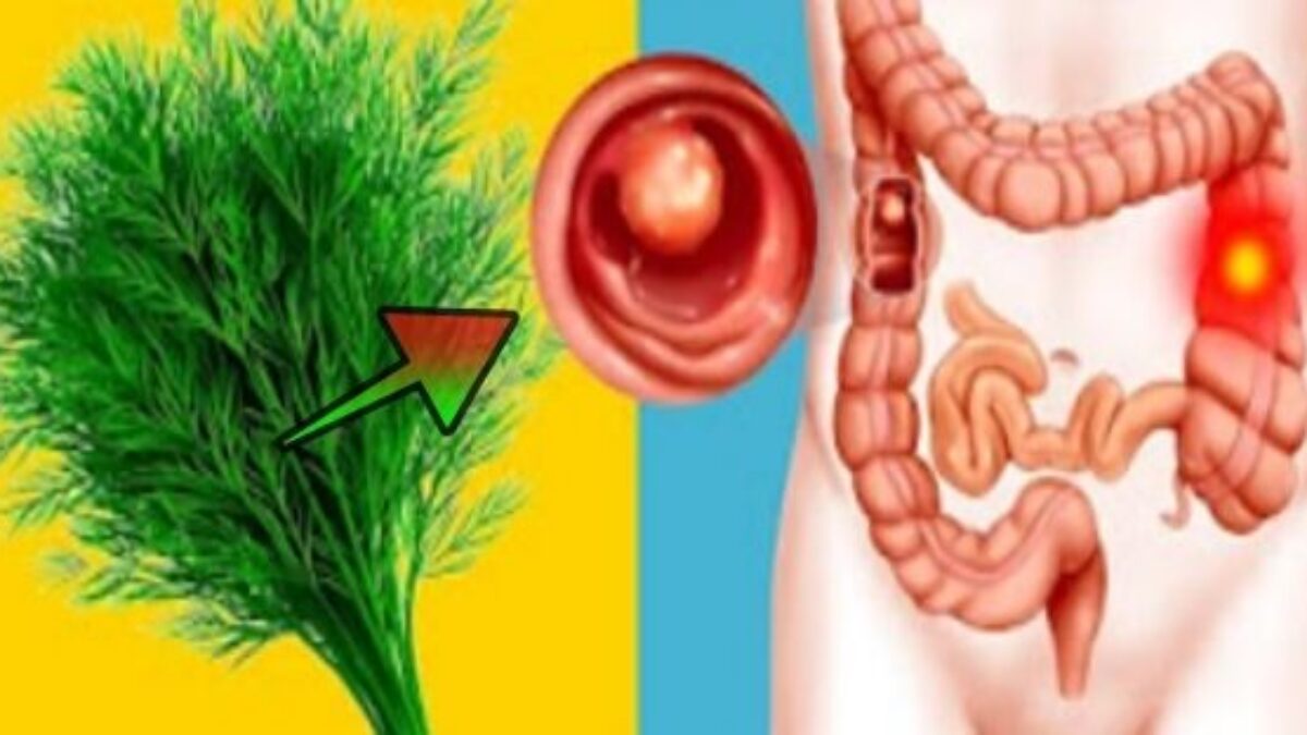 Skutočne OBROVSKÝ poklad prírody: Rastlina, ktorá je ešte oveľa účinnejšia ako cesnak – Znižuje krvný tlak a s cukrom v krvi robí divy.