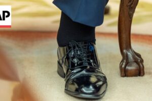 Čo je chronická žilová nedostatočnosť? Vysvetľuje cievny chirurg