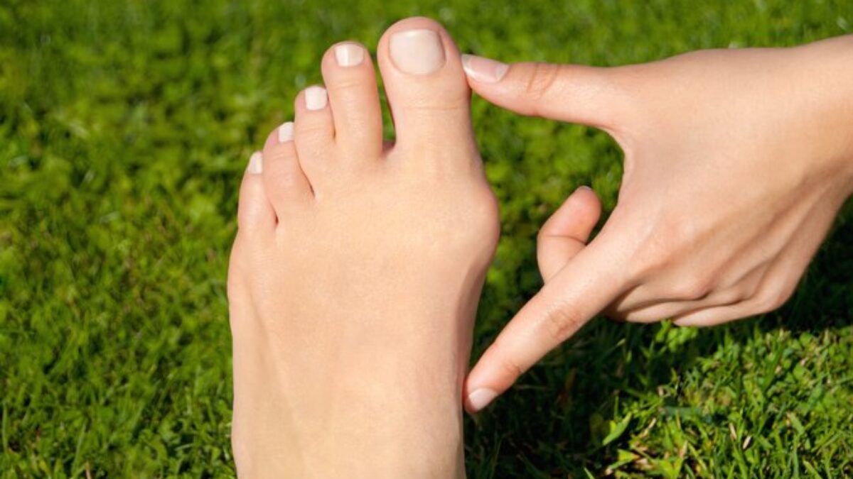 Vbočené palce: Odborníci radia, ako si s halluxmi vybrať topánky, v ktorých nebudete trpieť