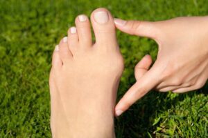 Vbočené palce: Odborníci radia, ako si s halluxmi vybrať topánky, v ktorých nebu...