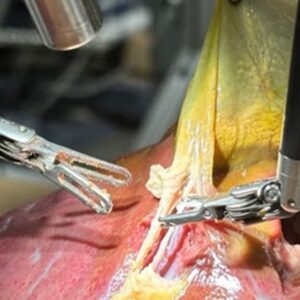 Je budúcnosť medicíny tu? Robot prvýkrát zvládol chirurgický zákrok s hovorenými...