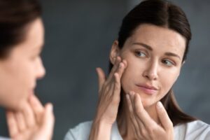 Suchá pokožka v lete: Čo zvládnete domácou starostlivosťou a kedy ísť za odborní...