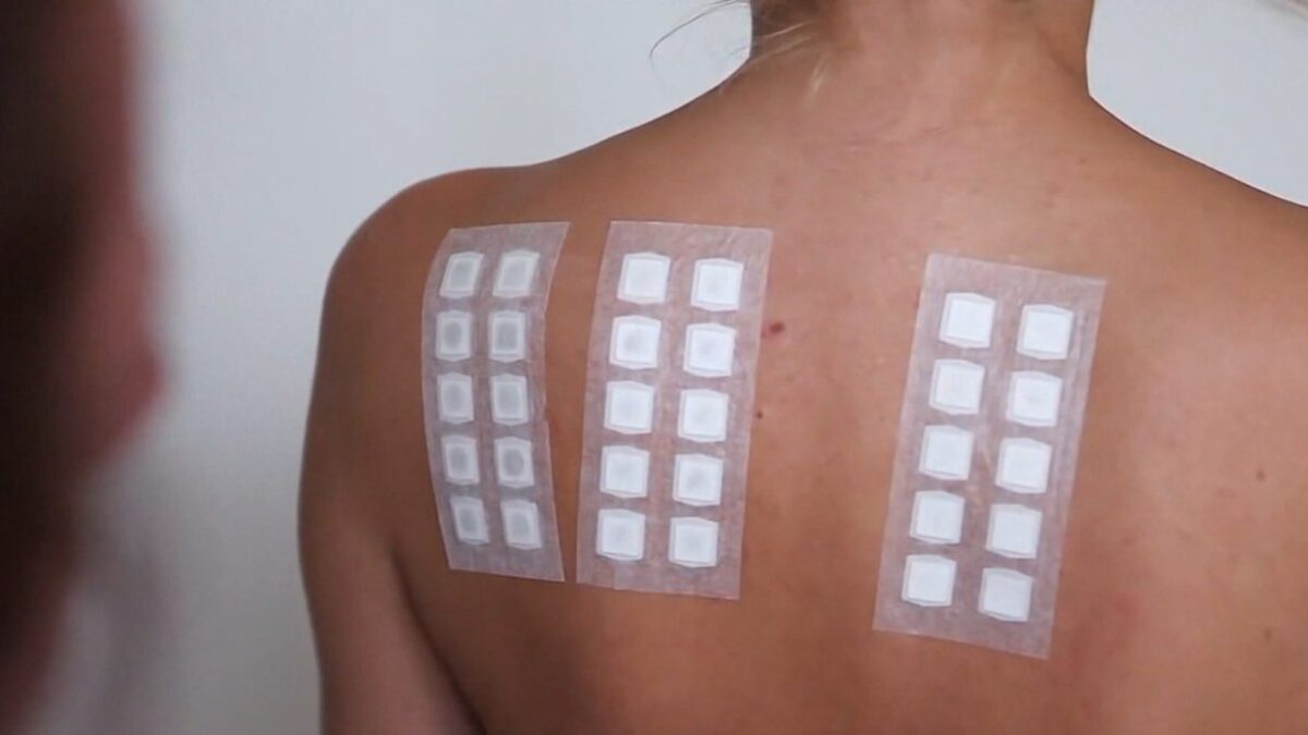 Odborníci pri upozorňujú na riziká alergií počas celého roka.