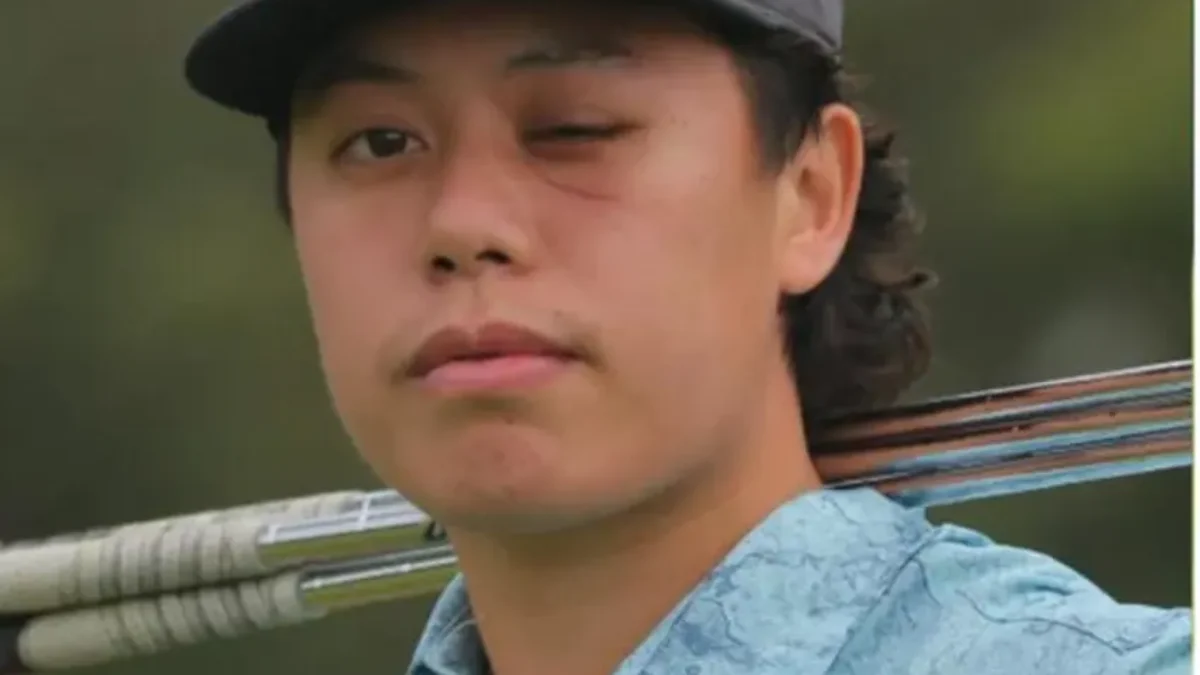 Jeffrey Guan sa pripravuje na prvý turnaj po život meniacej nehode.