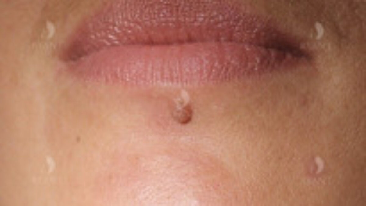 Odstránenie znamienok, bradavíc a ochlpenia, vymazanie HTML značiek z názvu, nepridávanie ikon a emoji do názvu