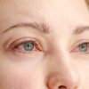 Nepohoda v oku: Ako riešiť najčastejšie očné problémy?