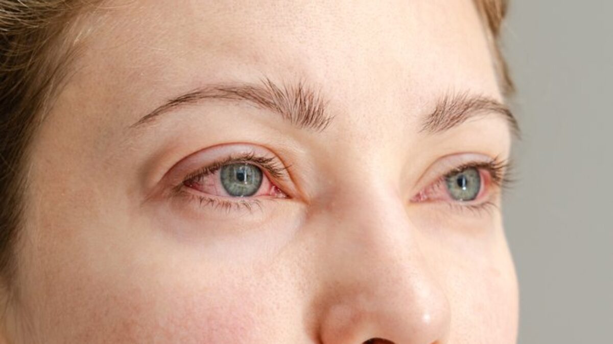 Nepohoda v oku: Ako riešiť najčastejšie očné problémy?