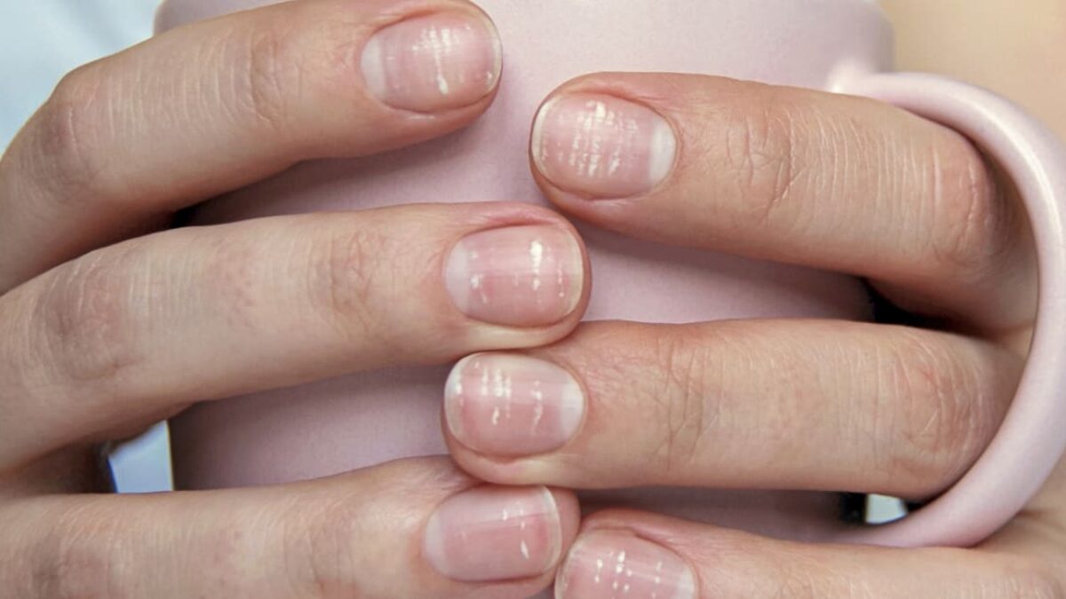 Rastú vlasy a nechty v lete rýchlejšie? Dôkladný výskum odhalil, či je táto „stará známa vec“ pravdivá