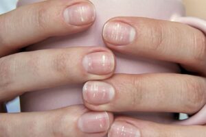 Rastú vlasy a nechty v lete rýchlejšie? Dôkladný výskum odhalil, či je táto R...