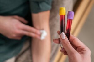 Strážte si hladinu homocysteínu: Zistíte z nej, že telo nefunguje Strážte si hladinu homocysteínu: Zistíte z nej, že telo nefunguje dobre