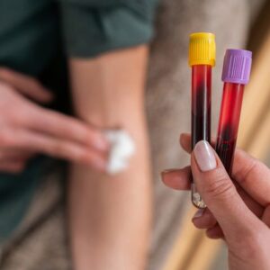 Strážte si hladinu homocysteínu: Zistíte z nej, že telo nefunguje Strážte si hladinu homocysteínu: Zistíte z nej, že telo nefunguje dobre