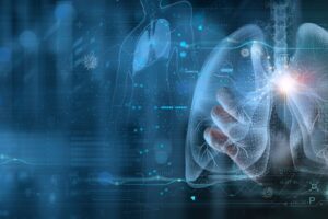 Chrípka a COVID-19 môžu prebudiť spiacu rakovinu. Časovaná bomba sa ukrýva v pľú...