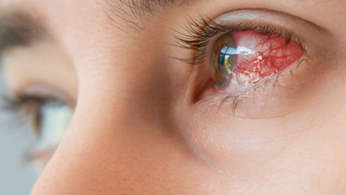 Do oka mu voperovali zub a začal vidieť. Zázračné vrátenie zraku kupodivu nie je novinkou