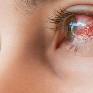 Do oka mu voperovali zub a začal vidieť. Zázračné vrátenie zraku kupodivu nie je...