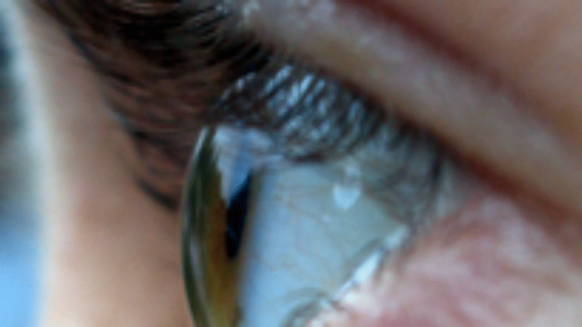 Čo obsahuje komplexné vyšetrenie zraku?