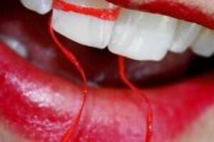 Päť krokov pre váš úsmev na celý život