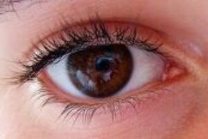 Suché a pálivé oči – alergie alebo syndróm?