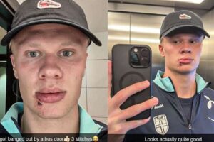 Haaland a bizarné zranenie: Nórsky útočník sa pochválil stehmi