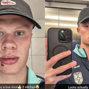 Haaland a bizarné zranenie: Nórsky útočník sa pochválil stehmi