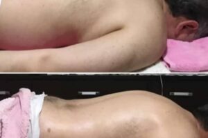 Meridiánová terapia –rehabilitácia