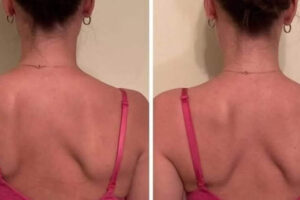 Vysledky hovoria za nás . Ako prebieha a čo to je ?