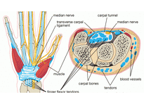 Syndróm karpálneho tunela: choroba z počítača, klavíra, ihly aj zbíjačky