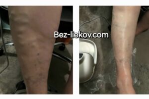 Výsledok po 50 minútach s naším REVITALIZÁTOROM .CHCETE ? Čakáme Vás