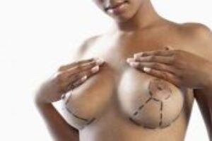 Kedy a prečo podstúpiť plastickú operáciu?