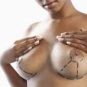 Kedy a prečo podstúpiť plastickú operáciu?