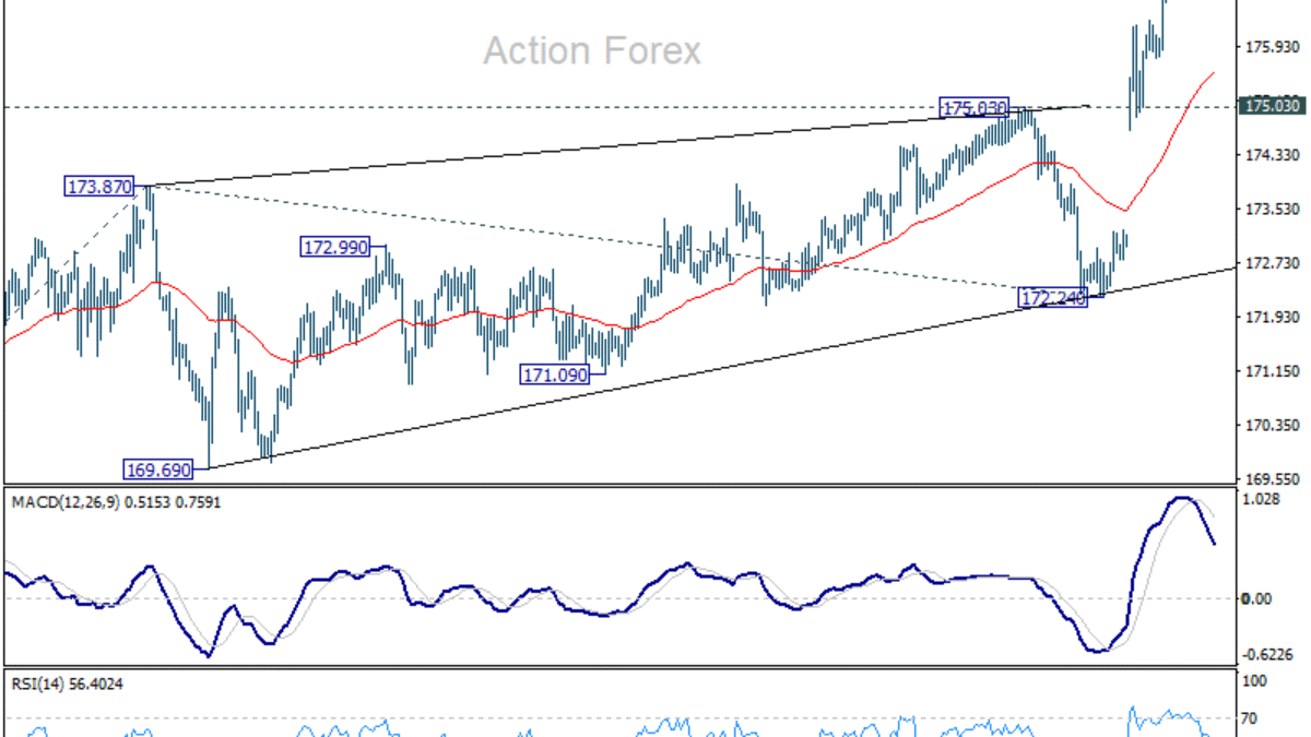 EUR/JPY Denný Výhľad EUR/JPY Denný Výhľad