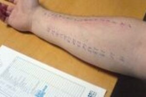 Ako rozoznať virózu od alergie?