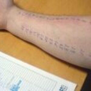 Ako rozoznať virózu od alergie?