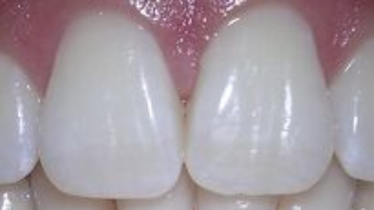 Zuby nemajú radi drhnutie, kyslé potraviny a tvrdé kefky