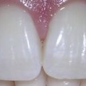 Zuby nemajú radi drhnutie, kyslé potraviny a tvrdé kefky