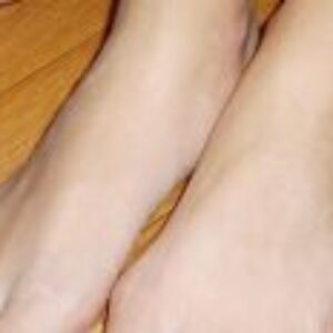 Ako sa vyhnúť letnej mykóze?