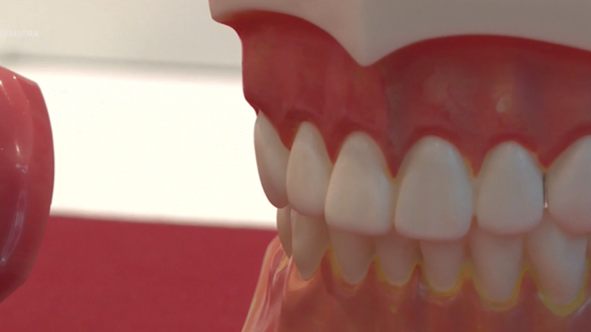 Zubné strojčeky ponúkajú aj ambulancie bez odborníkov.