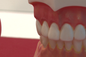 Zubné strojčeky ponúkajú aj ambulancie bez odborníkov.