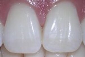 4 chyby v starostlivosti o zuby - robíte ich aj 4 chyby v starostlivosti o zuby – robíte ich aj vy?