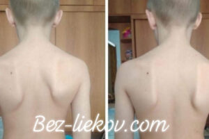 AJ DETI môžu absolvovať našu meridiánovu terapiu podľa TRADIČNEJ ČÍNSKEJ MEDICÍN...