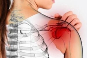 PERIARTRITÍDA RAMENA – úľava hneď po MERIDIÁNOVEJ TERAPII