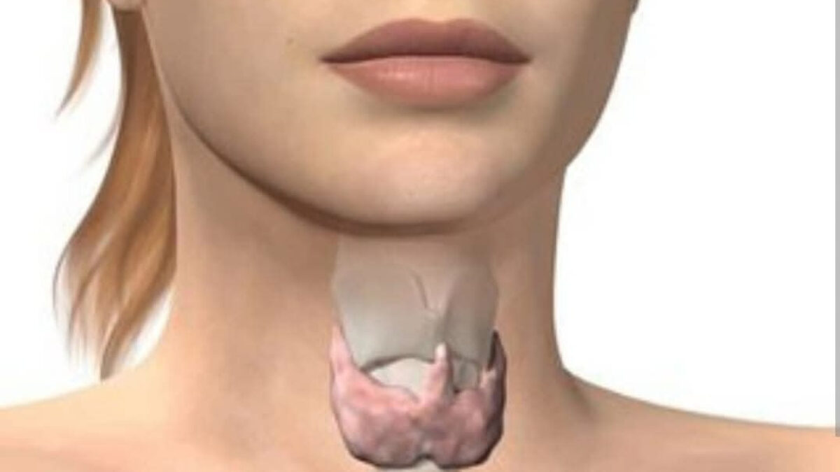 PROBLÉM SO ŠTÍTNU ŽĽAZOU? JE TU RIEŠENIE!