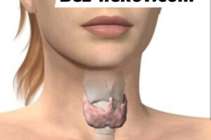 PROBLÉM SO ŠTÍTNU ŽĽAZOU? JE TU RIEŠENIE!